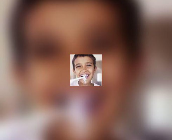 Prevention dentaire chez les enfants