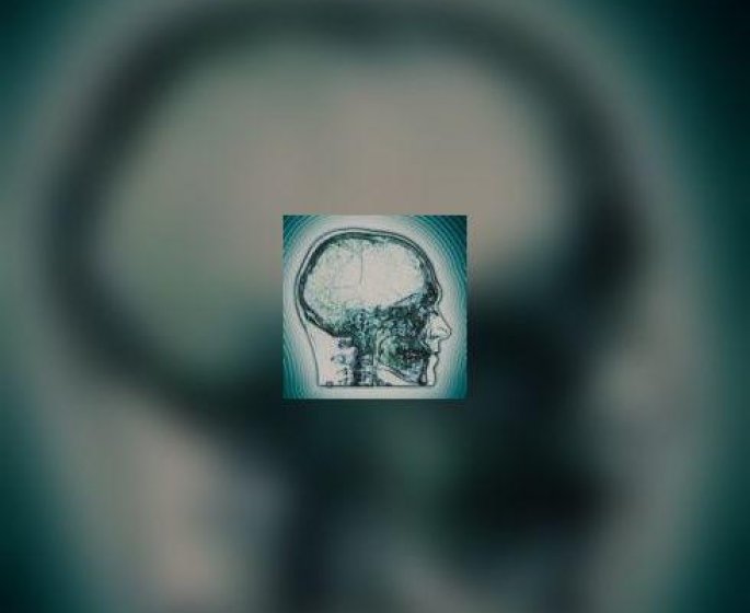 Cerebrotheque Parkinson : don de cerveau pour la recherche