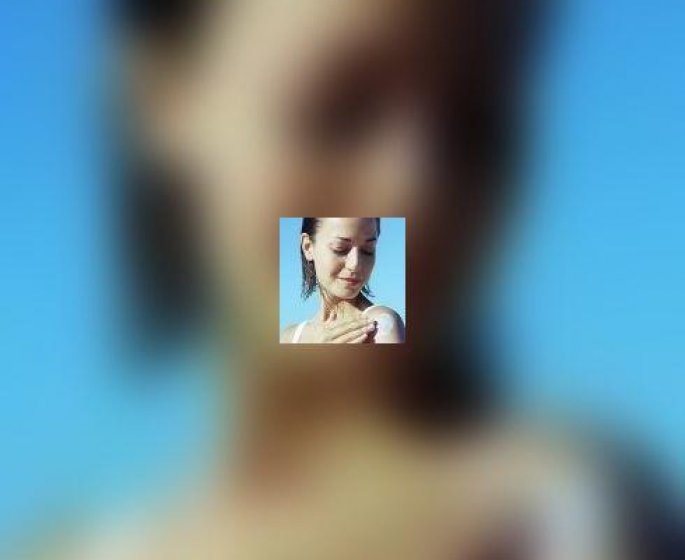 Cancer de la peau : il n-y a pas que les grains de beaute a surveiller !