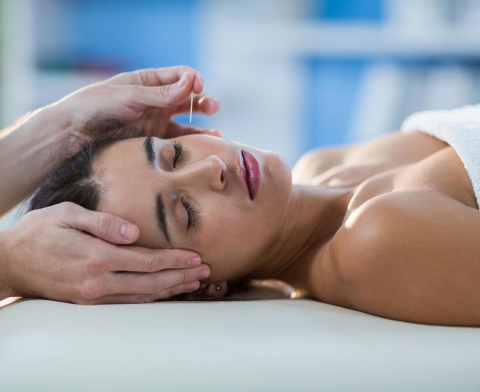 Esthetique : L’acupuncture me rend plus belle