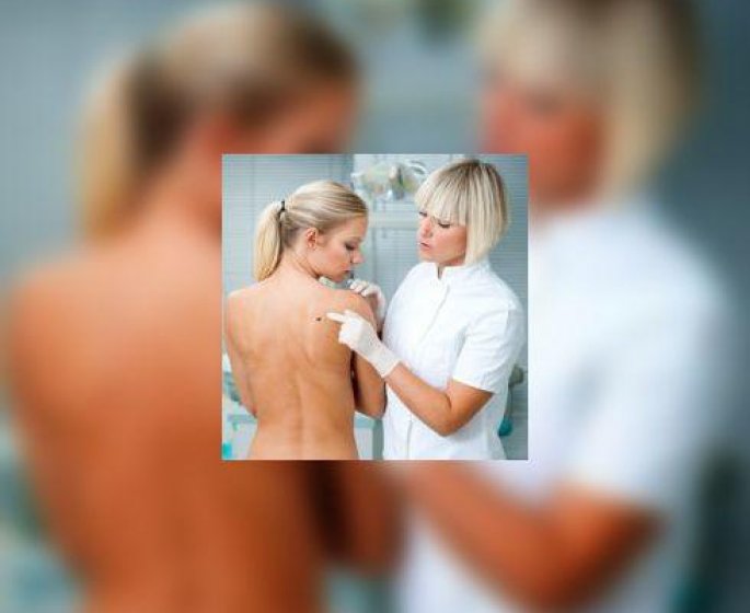 Melanome : etes-vous a risque ? Comment examiner votre peau ?