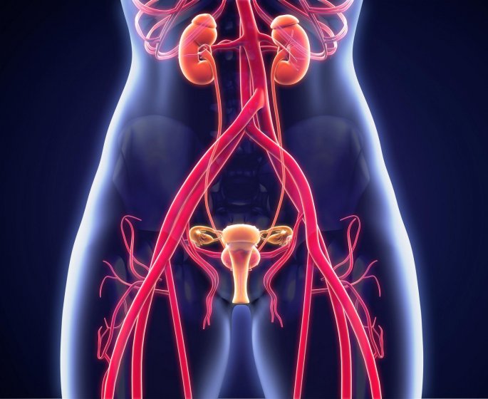 Cystite interstitielle ou syndrome de la vessie douloureuse