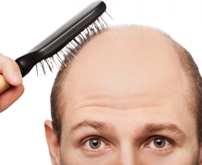 Comment venir a bout d’une chute de cheveux ?