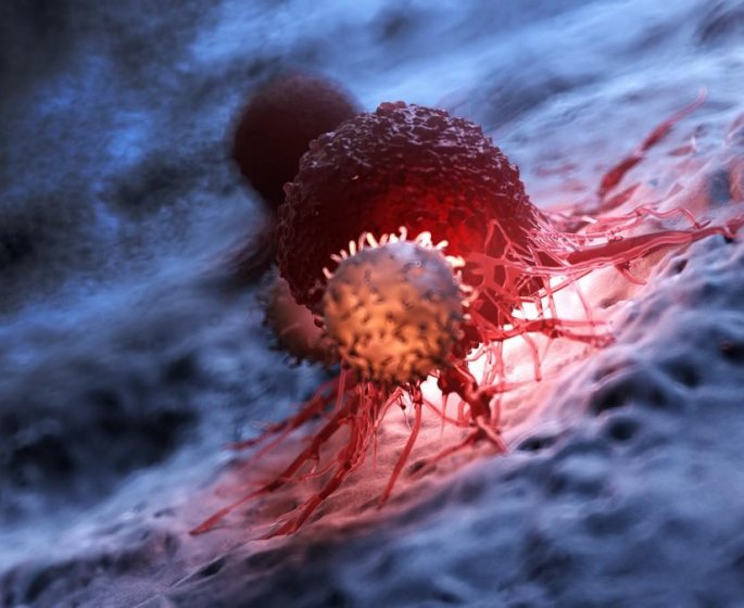 Les cancers les plus mortels chez la femme