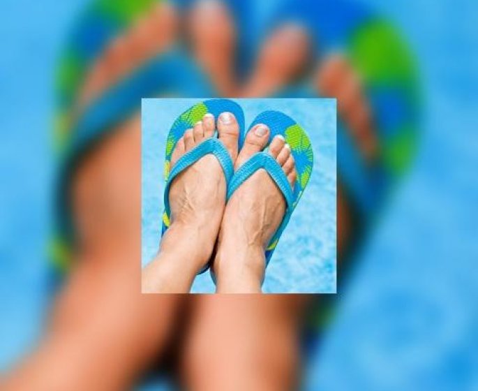 Tongs : vos pieds a la mode mais votre sante en danger !