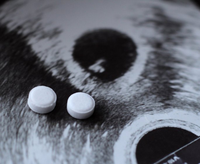 Traitement “inversant” les avortements : l’etude stoppee apres 3 hemorragies