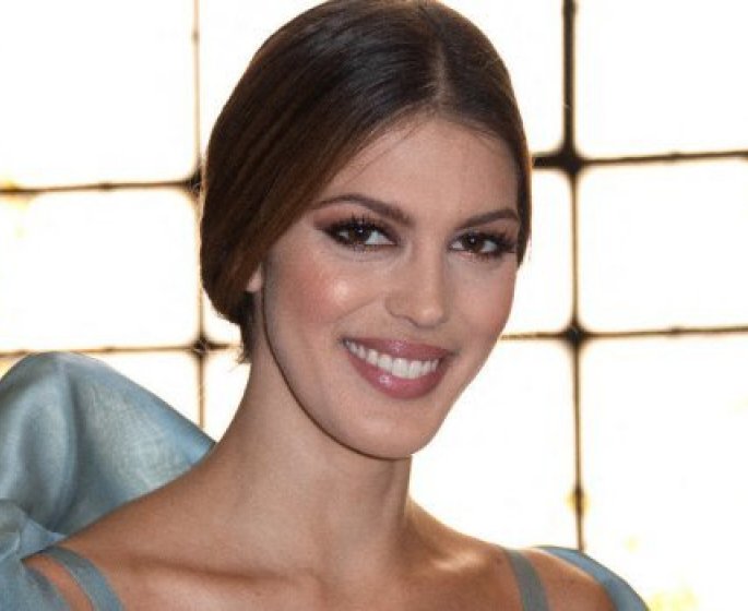 Image : Iris Mittenaere couverte de bleus apres un accident de karting