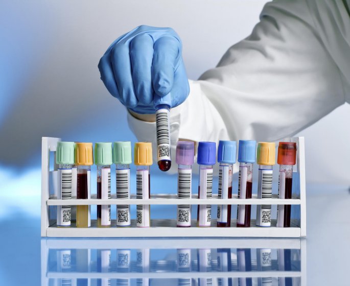 La creatinine, c’est quoi ?
