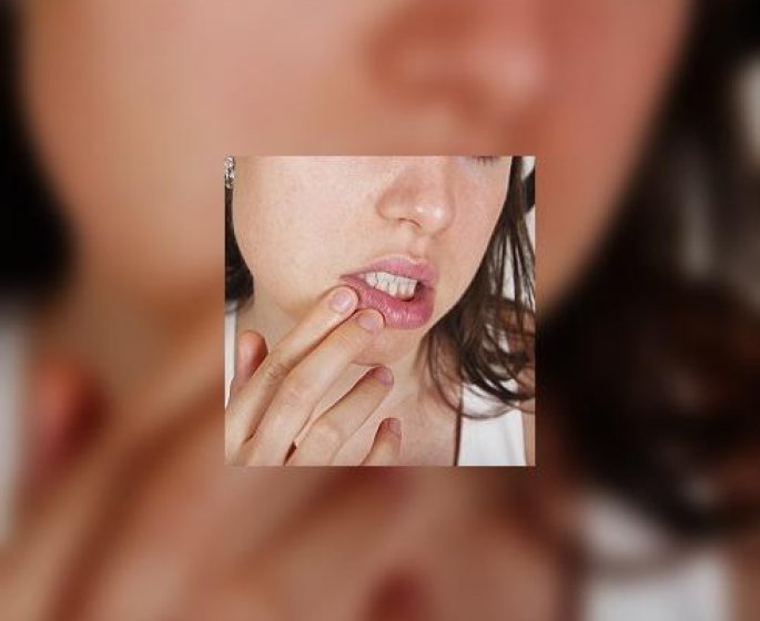 Herpes, c-est toujours le meme scenario