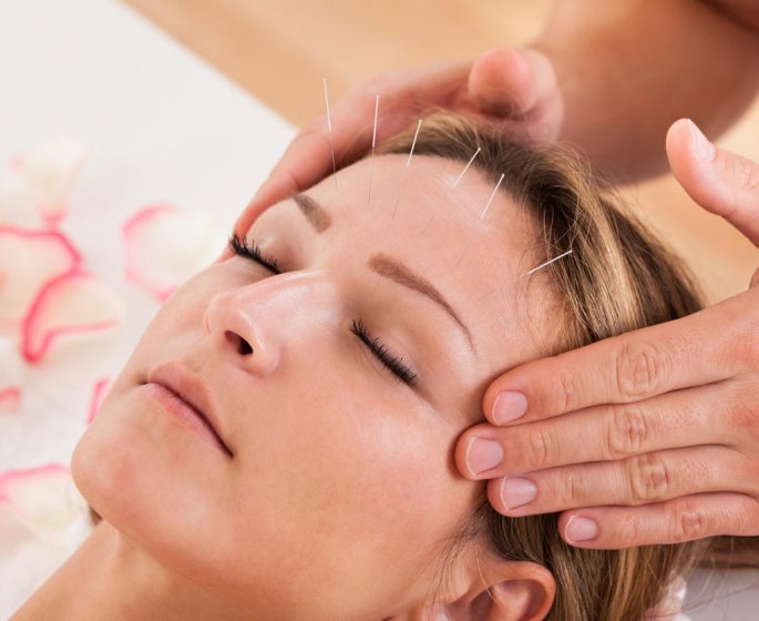 L-acupuncture soulage les petits maux de la grossesse