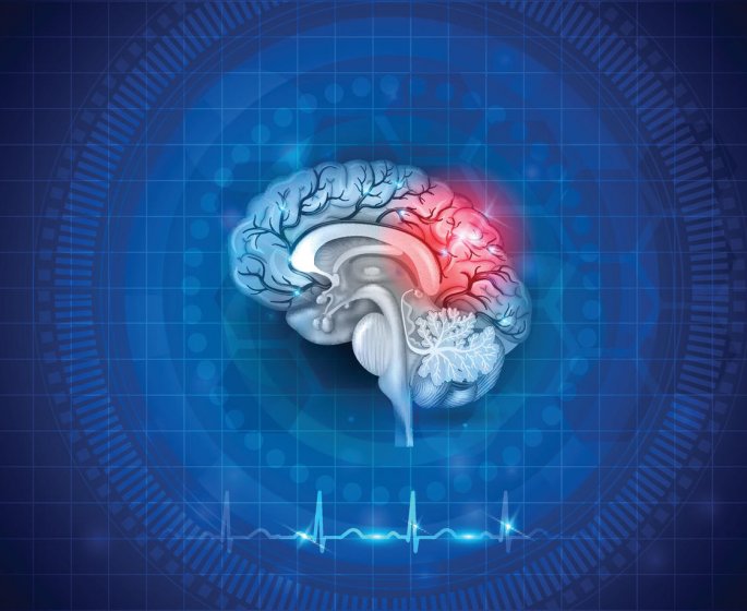 Comment reconnaitre un cancer du cerveau ?