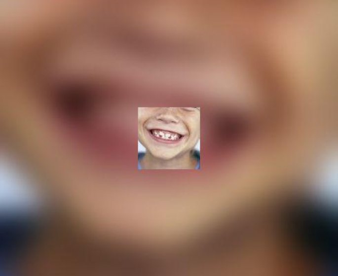 L-orthodontie : ca fait mal ?