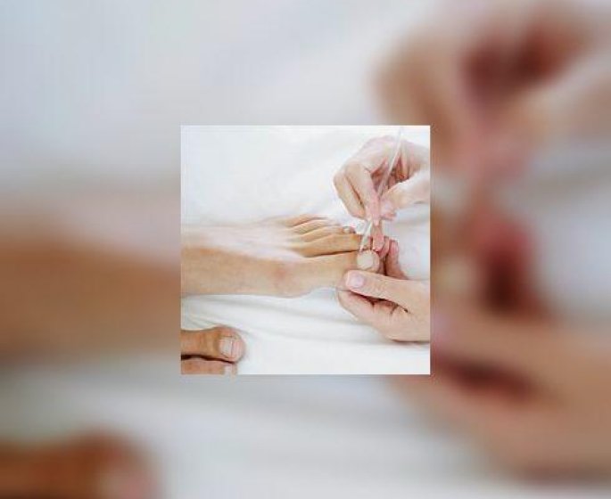 Comment venir a bout de ces cors et durillons qui nous cassent les pieds ?
