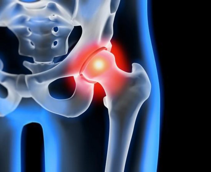 Osteoporose, je mange quoi ?
