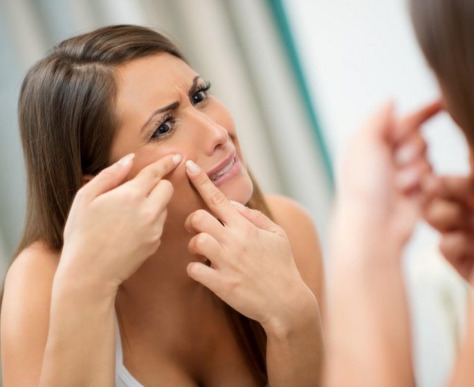 Acne : distinguez le vrai du faux !