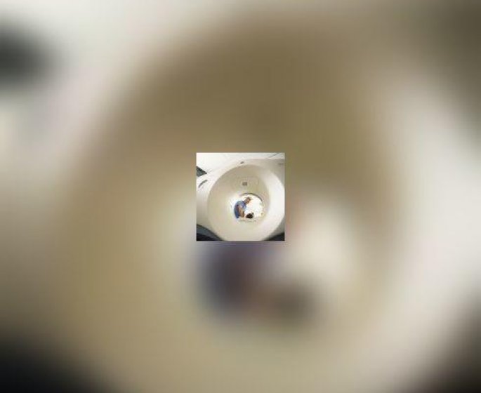 Scanner, IRM, scintigraphie, angiographie et echographie : comment ca marche ?