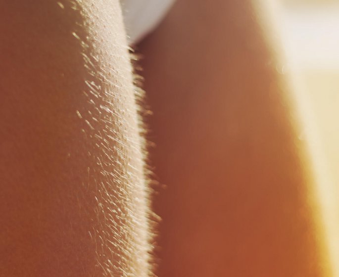 Exces de poils ? De l-hyperpilosite a l-hirsutisme