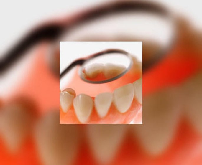 A quand le vaccin anti-caries ?