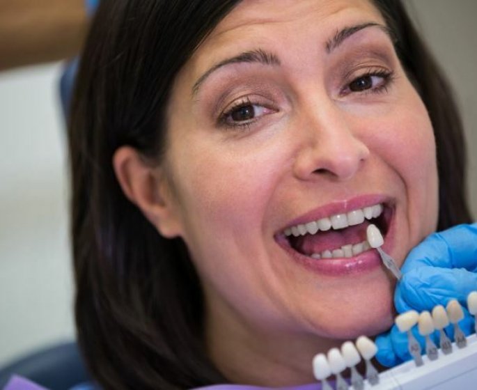 Esthetique dentaire : les differentes options disponibles en France