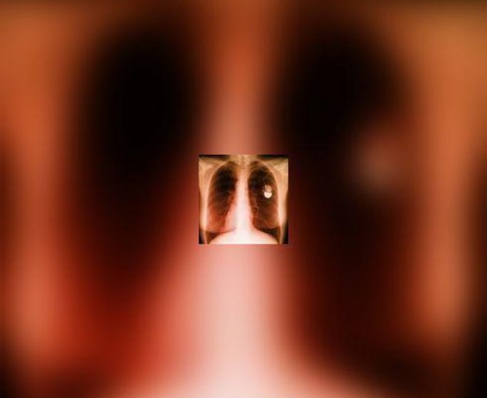 Ce qu-il faut savoir quand on porte un pacemaker