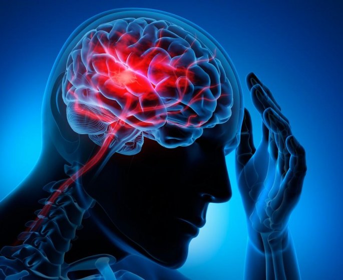 Accident vasculaire cerebral : connaissez-vous les signes d-alerte ?