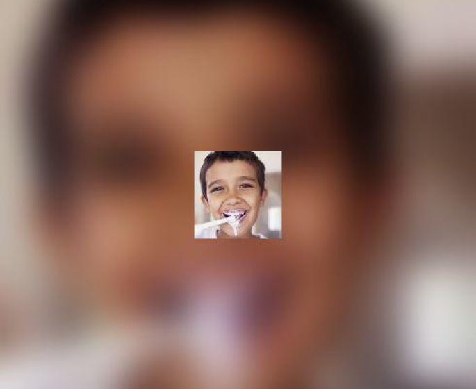 Orthodontie : comment bien se laver les dents avec un appareil dentaire ?
