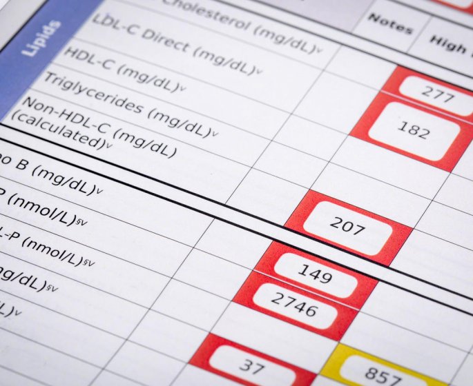 3 conseils pour diminuer le mauvais cholesterol