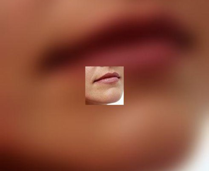 Rosacee, otez-moi ces rougeurs sur le visage !