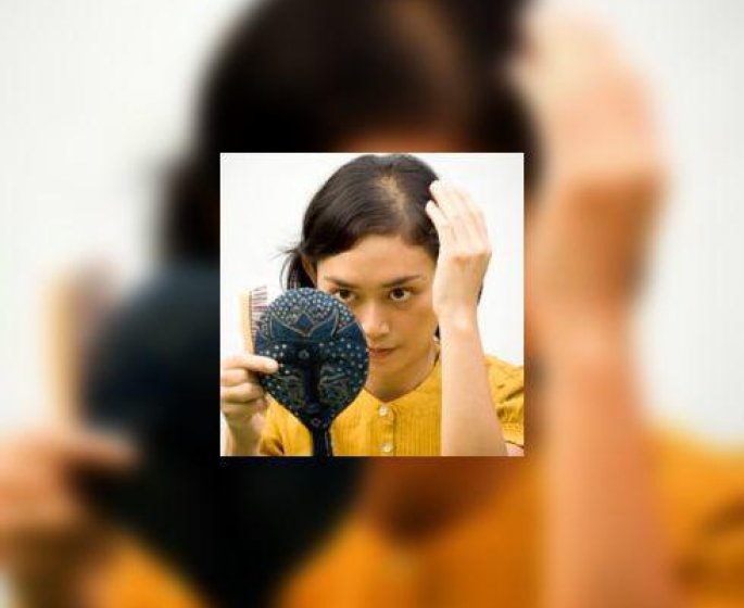 La pelade : quand les cheveux partent par plaques…