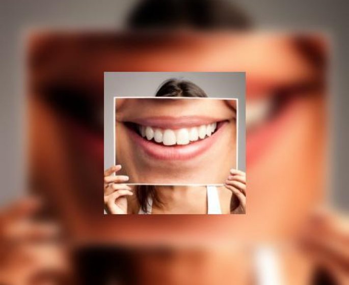 Apres les caries, l’usure des dents : la nouvelle affection buccodentaire ?