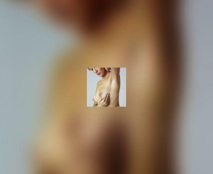 Cancer du sein : quels sont les facteurs de risque ?