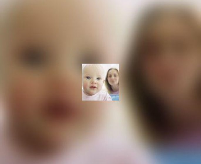 Meningite a meningocoque : reperer les symptomes