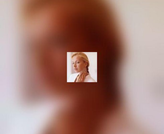 Psoriasis : l-arrivee des biotherapies