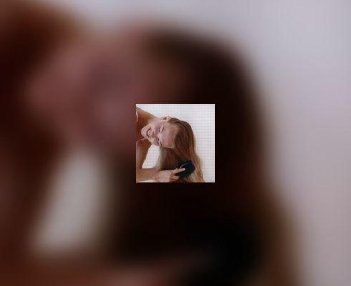 La chute des cheveux : mefiez-vous des traitements " miracles " !