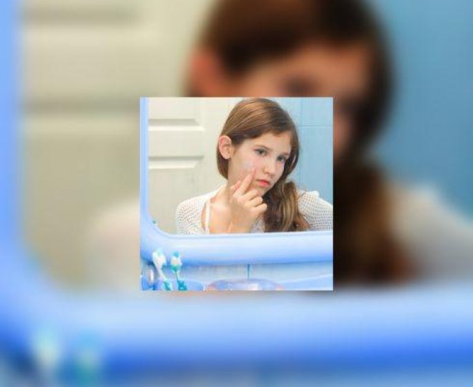 Medicaments contre l’acne : sont-ils vraiment dangereux ?
