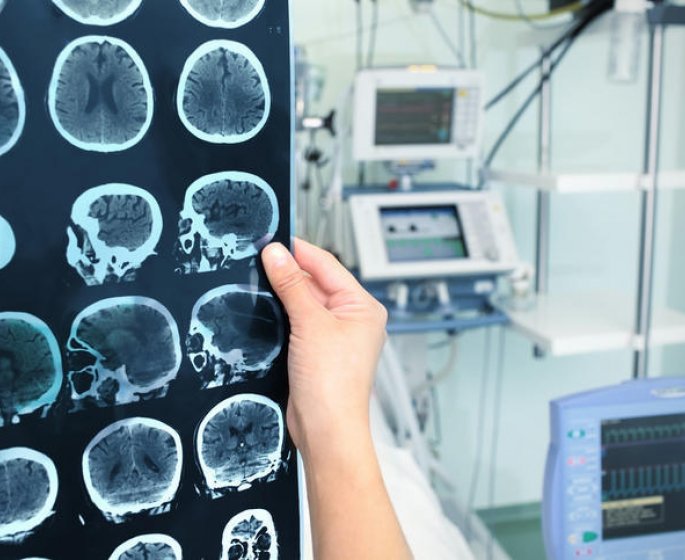 Alzheimer : comment evolue la maladie ?