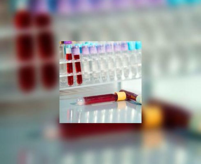 Cholesterol : plus besoin d’etre a jeun lors des analyses de sang