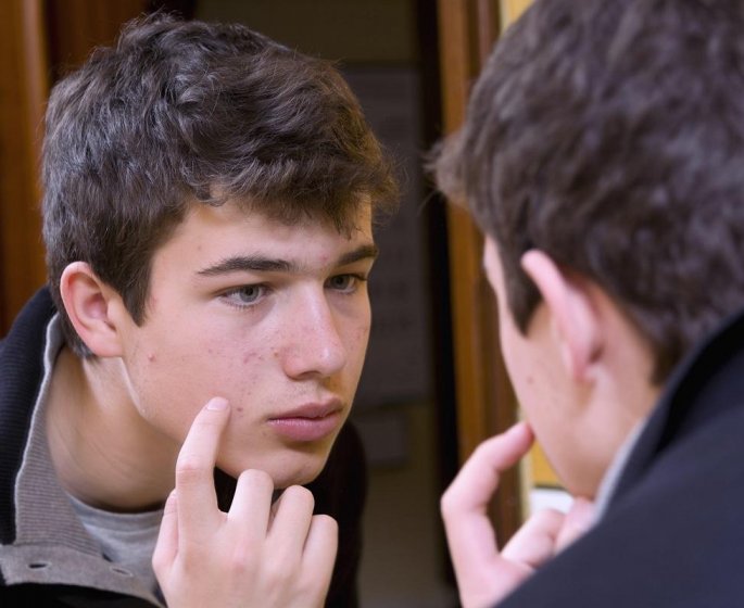 L’acne au masculin