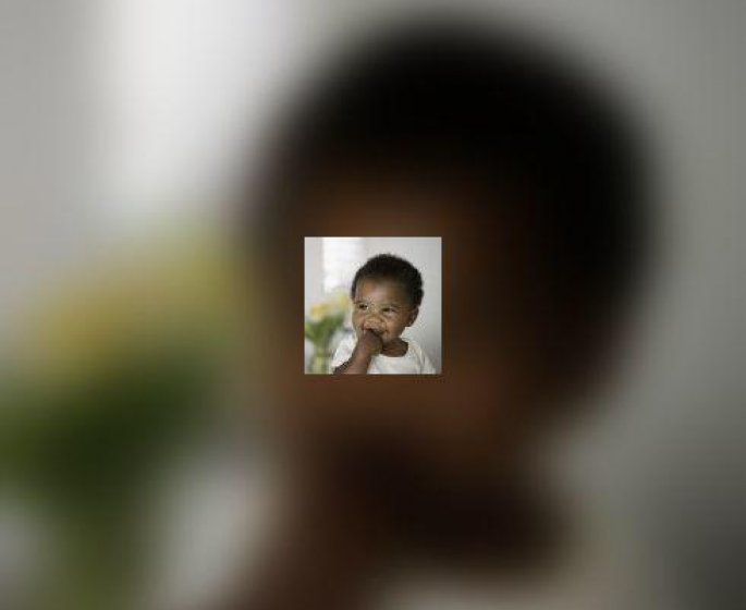 Meningites : en baisse de 31%