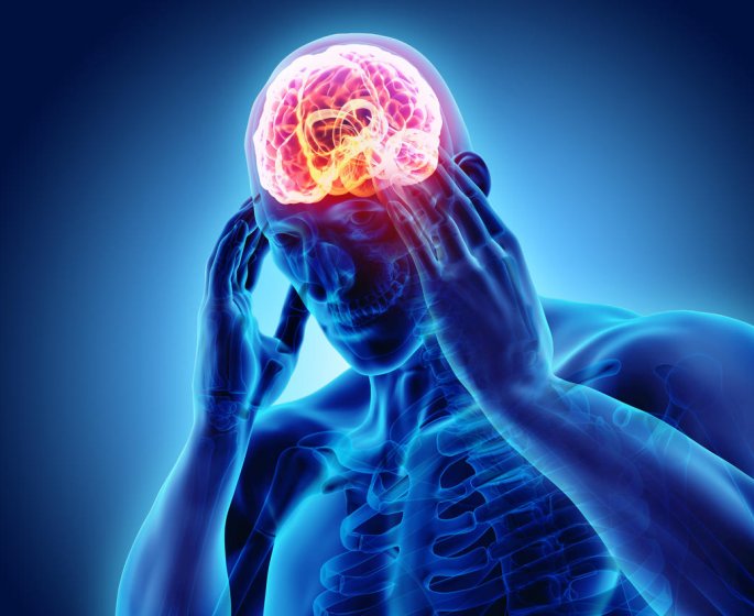 Migraine avec aura : un signe possible de cancer du cerveau ?