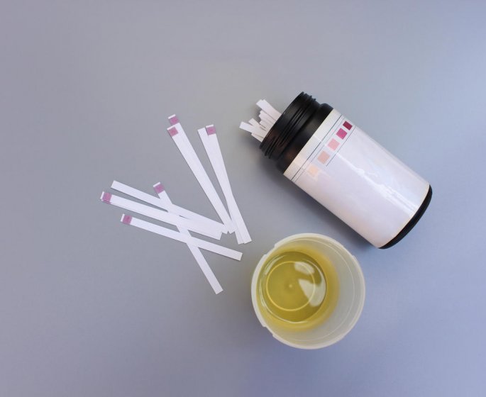 Infection urinaire : comment utiliser les tests par bandelette ?