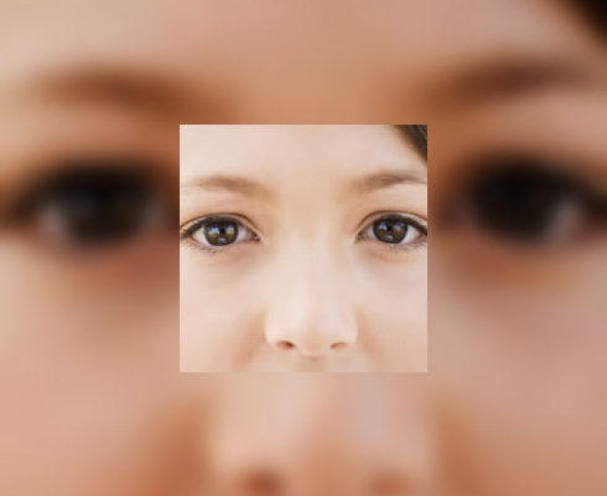 Conjonctivite : ne vous frottez pas les yeux !