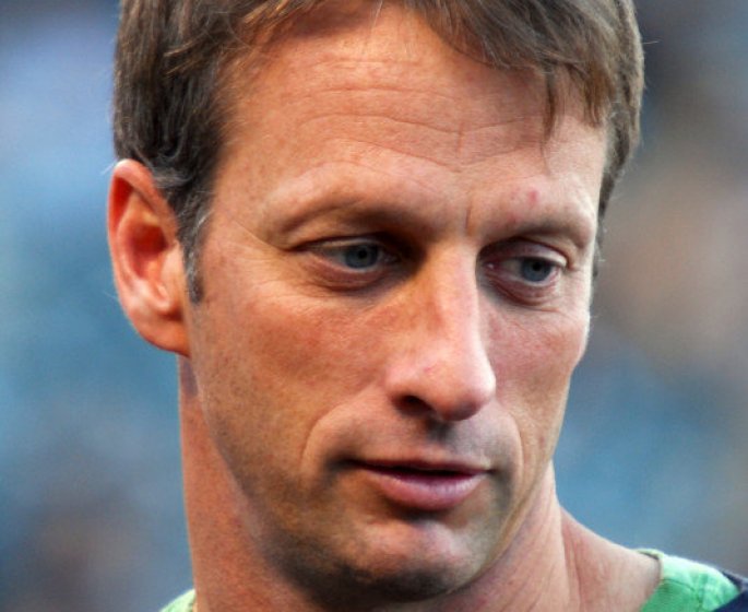 Tony Hawk devoile les radios effrayantes de ses doigts apres un accident de skate