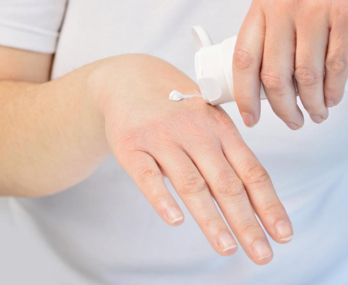 Cortisone : ses indications comme traitement de l-allergie