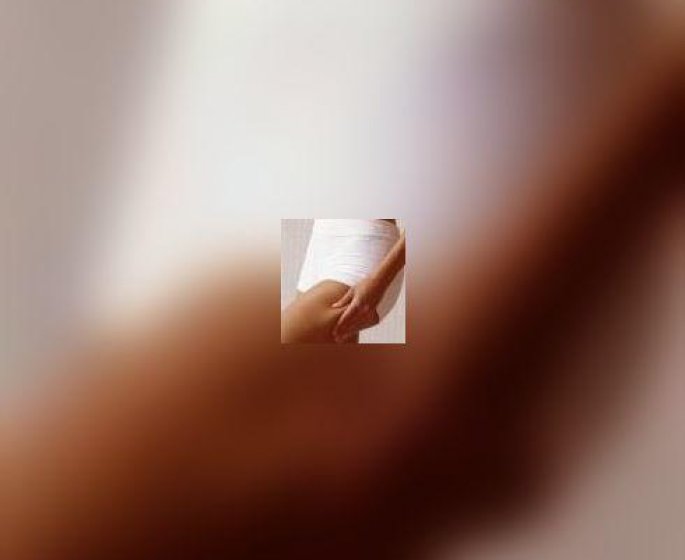 Vergetures : mieux vaut prevenir
