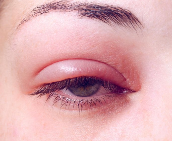Orgelet : a quoi est du ce "bouton" de l-œil ?