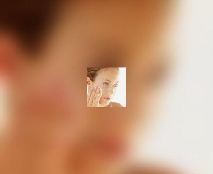 Reponse a vos forums : comment eviter les boutons de fievre de l-herpes ?