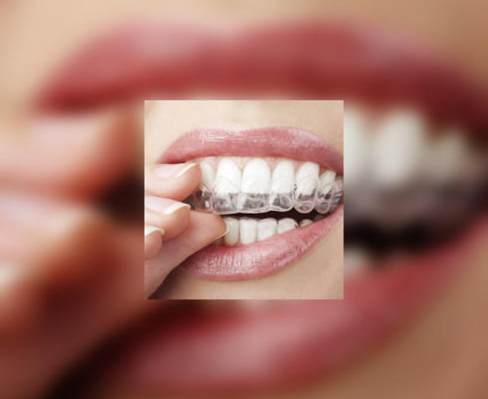 Orthodontie : des techniques ultramodernes pour un beau sourire