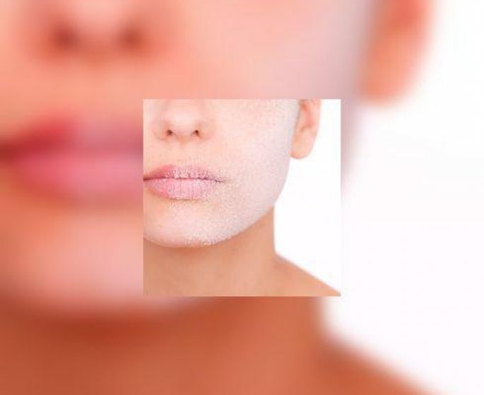 Psoriasis : les proches, premier soutien