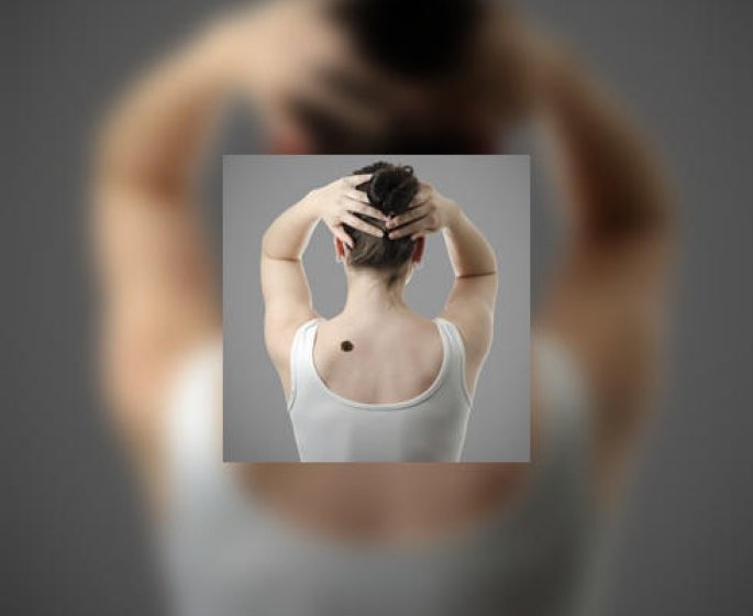 Angiome : pourquoi et comment traiter ?